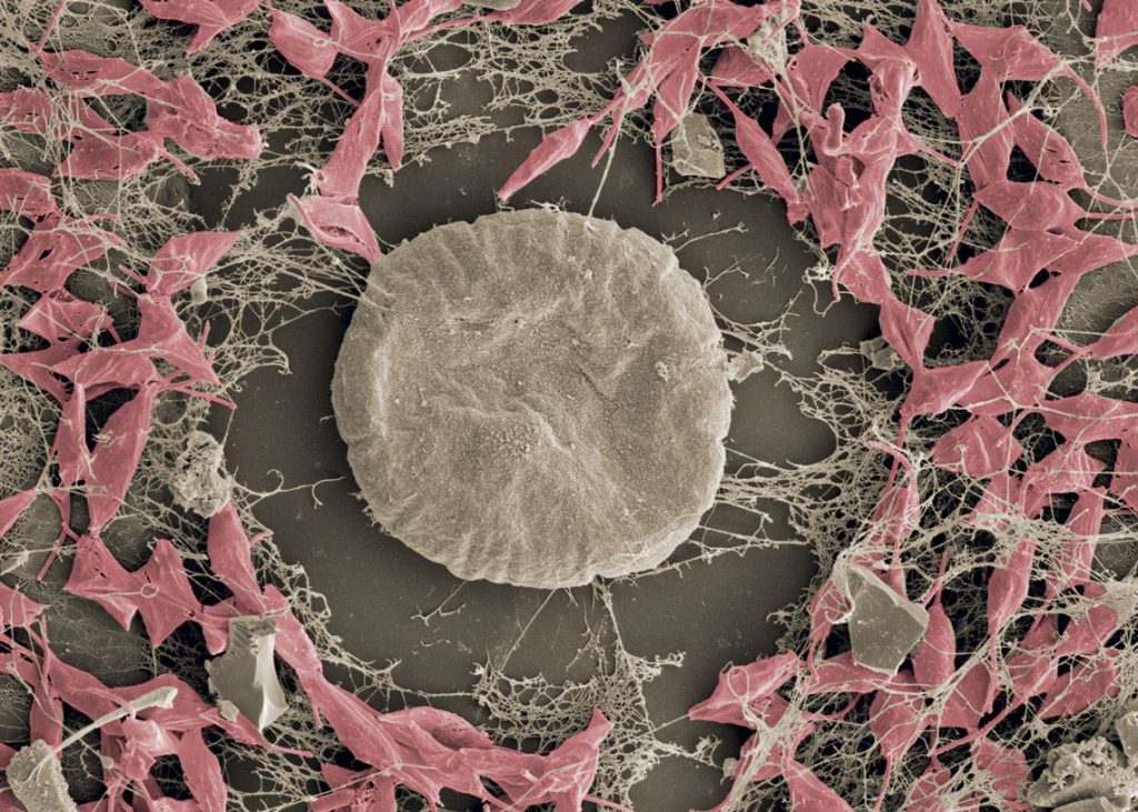 Falschfarben-Elektronenmikroskopie von Trypanosoma cruzi während der Interaktion mit einer Wirtszelle und ihrer Zelloberfläche.