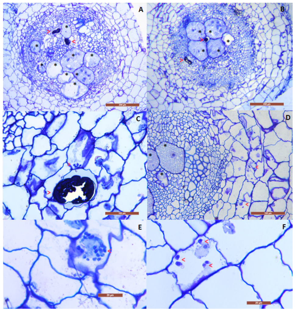 Pochonia chlamydosporia in Tomatenwurzeln: lichtmikroskopische Querschnitte von durch Meloidogyne incognita verursachten Wurzelgallen mit Riesenzellen, Nematoden sowie Chlamydosporen und Hyphen des endophytischen Pilzes.