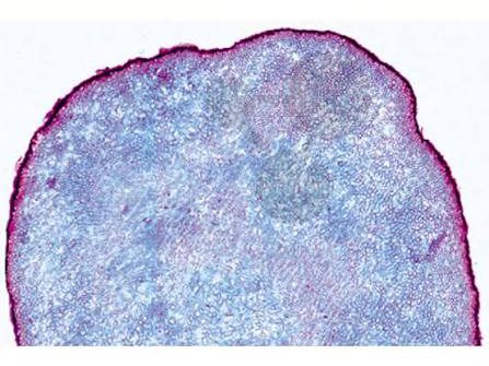Mikroskopischer Querschnitt durch ein Sklerotium des Mutterkornpilzes Claviceps purpurea mit charakteristischem Pilzgewebe